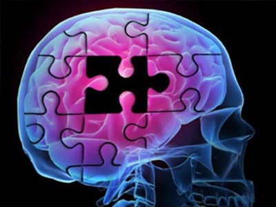 Οι πάσχοντες από Αλτσχάιμερ αναμένεται να τριπλασιαστούν έως το 2050